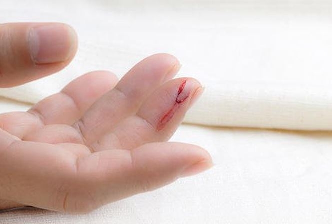 Mơ thấy đứt ngón tay chảy nhiều máu